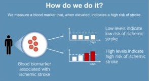 predict and prevent ischemic stroke