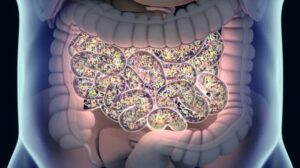 estoring the Gut Walls Could Help Save Brain Function After Stroke