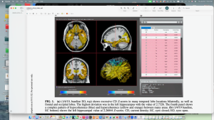 Photobiomodulation Stroke Recovery